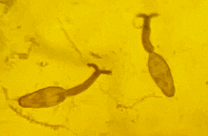 一旦接触，10秒即可感染！汛期谨防这种病→