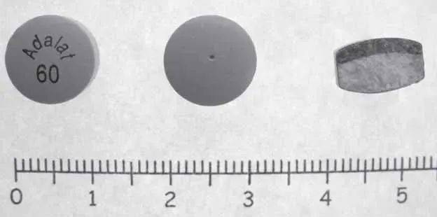 从屎里扒拉出完整药片,他决定洗洗再吃下去,就此再也不用买药了!